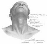 Photos of Goiter Right Side Neck