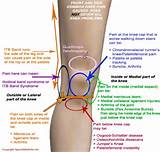 Knee Pain Symptoms Pictures
