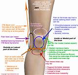 Knee Injury Pain Behind Knee Images