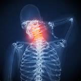 Pictures of Nerve Pain Relief Neck