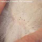 White Sand On Scalp Images