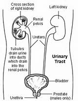 Photos of Urinary Tract Neoplasm