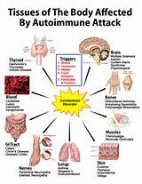 Images of Autoimmune Disease Blood