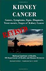 Pictures of Signs And Symptoms Kidney Cancer