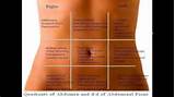 Pictures of What Causes Left Side Abdominal Pain