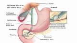 Symptoms Of Gallbladder Problems Images