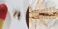 What Does a Head Lice Bug Look Like