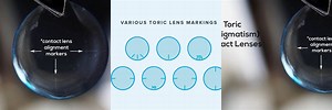 Toric Marking On Soft Contact Lens