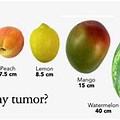 6 Cm Tumor Picture