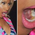 Nicki Minaj Yellow Plaque Teeth