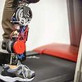 Robotic Artificial Limbs