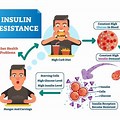 Type 2 Diabetes Cartoon Insulin-Resistance