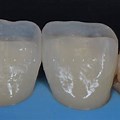 Unicore Dental Composite Image