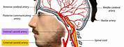 Carotid Artery Map