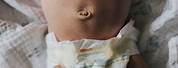 Newborn Baby Belly Button