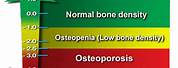 Osteoporosis Bone Density Chart