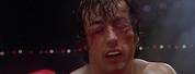 Rocky Balboa After Fight