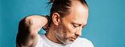 Thom Yorke Hair Transplant