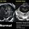 Abnormal Fetal Brain Ultrasound
