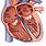 Atrial Heart