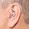 Behind the Ear Hearing Aid with Earmold