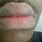 Black Crusty Lips