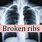 Broken Ribs Symptoms