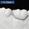 C Clasp Denture