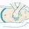 CPR Animation GIF