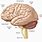 Cerebral Anatomy