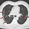 Covid 19 Lung CT Scan