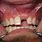 Dental Implant Bone Graft After
