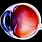 Ganglion Cells Eye