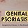 Genital Psoriasis Symptoms