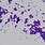 Gram Stain of Staphylococcus