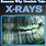 How to Read Dental X-rays