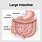 Large Intestine Diseases