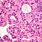 Liver Cancer Cells