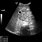 Liver Ultrasound GIF