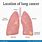 Lower Lobe Lung Cancer