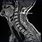 MRI Cervical Spine Sagittal