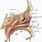 Maxillary Sinus Antrostomy