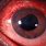 Panuveitis Eye