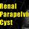 Parapelvic Renal Cyst Ultrasound