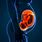 Placenta Fetal Side