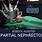 Robotic Partial Nephrectomy