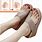 Sandals for Feet with Bunions