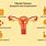 Signs of Fibroids