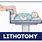 The Patient in Lithotomy Position