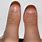 Toe Thumb Syndrome